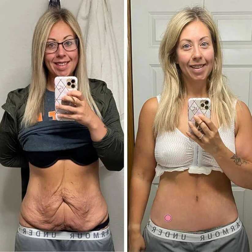 GLP-1 Parches (30 + 60 GRATIS)